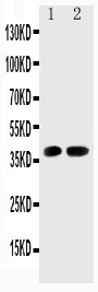 1 - Anti-Cdk6 Antibody ABO11432