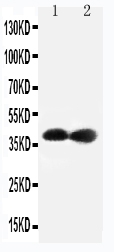 1 - Anti-Cdk7 Antibody ABO11433