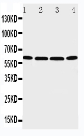 1 - Anti-P2X6 Antibody ABO11436