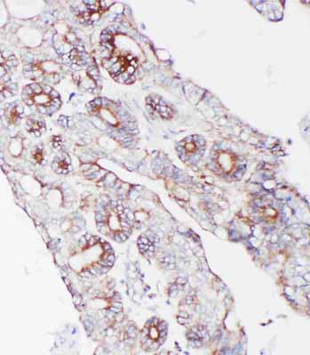 2 - Anti-PCSK9 Antibody ABO11438