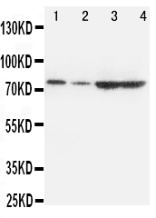 1 - Anti-PCSK9 Antibody ABO11438