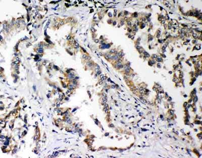 2 - Anti-PLK2 Antibody ABO11439