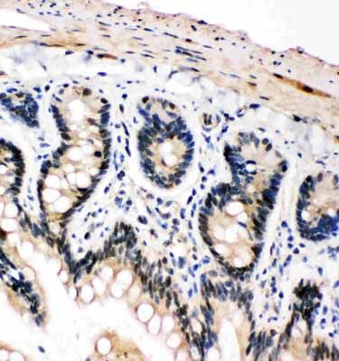 2 - Anti-PLK2 Antibody ABO11439