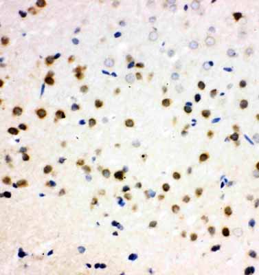 2 - Anti-PLK2 Antibody ABO11439
