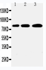 1 - Anti-PLK2 Antibody ABO11439
