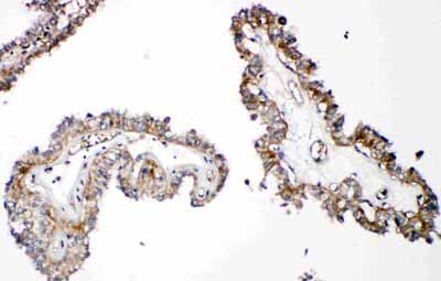 2 - Anti-Parathyroid Hormone Receptor 1 Antibody ABO11440