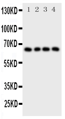 1 - Anti-Parathyroid Hormone Receptor 1 Antibody ABO11440