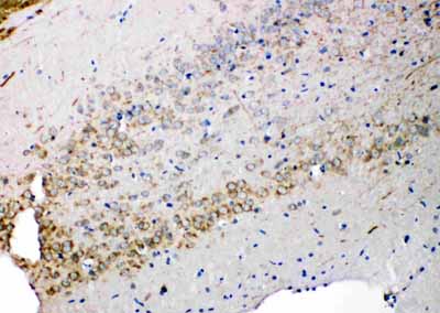 2 - Anti-Syndecan 3/SDC3 Antibody ABO11441