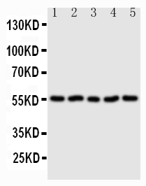 1 - Anti-Syndecan 3/SDC3 Antibody ABO11441