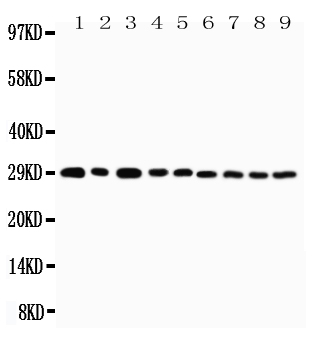1 - Anti-TNFRSF4/OX40 Antibody ABO11444