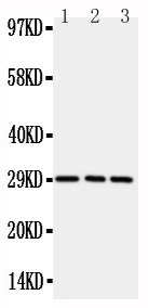 1 - Anti-TNFRSF4/OX40 Antibody ABO11446