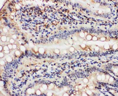2 - Anti-VCP Antibody ABO11447