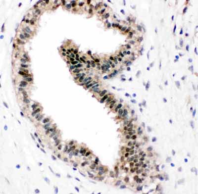 2 - Anti-VCP Antibody ABO11447