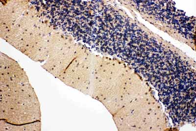 2 - Anti-VCP Antibody ABO11447