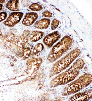 2 - Anti-VCP Antibody ABO11447