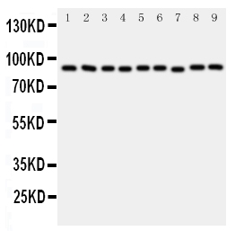 1 - Anti-VCP Antibody ABO11447