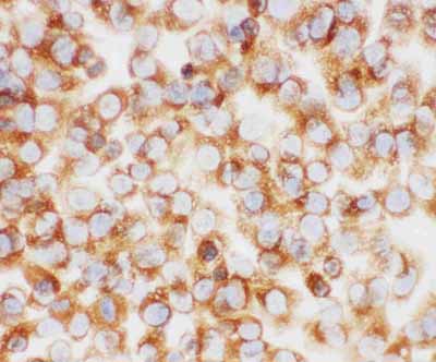 8 - Anti-Collagen I Antibody ABO11450