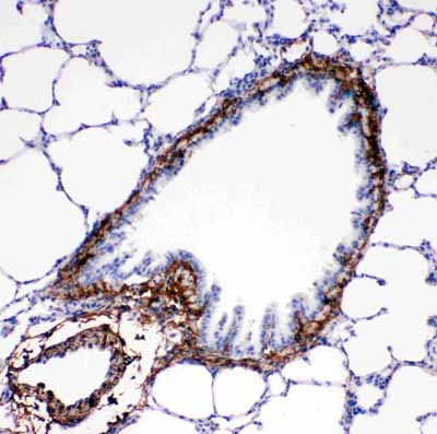 2 - Anti-Collagen I Antibody ABO11450