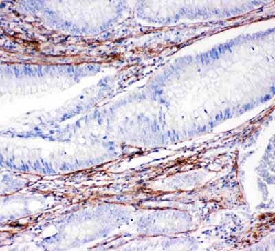 2 - Anti-Collagen I Antibody ABO11450