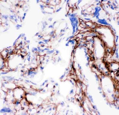 2 - Anti-Collagen I Antibody ABO11450