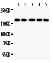 1 - Anti-Collagen II Antibody ABO11451