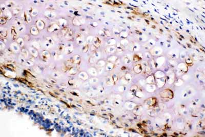 2 - Anti-Collagen II Antibody ABO11452
