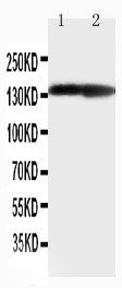 1 - Anti-Collagen II Antibody ABO11452