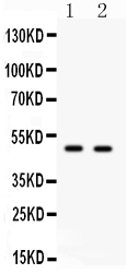 1 - Anti-E2F3 Antibody ABO11453