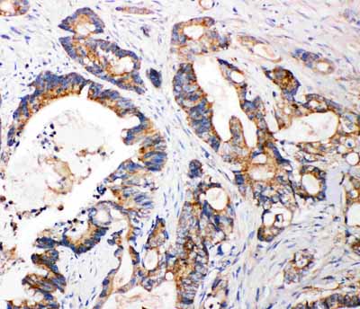 2 - Anti-FGFR3 Antibody ABO11454