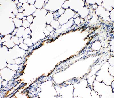2 - Anti-FGFR3 Antibody ABO11454