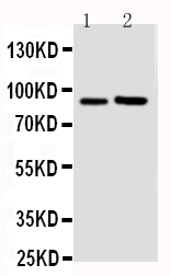 1 - Anti-FGFR3 Antibody ABO11454