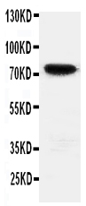 1 - Anti-HIF3 Antibody ABO11455