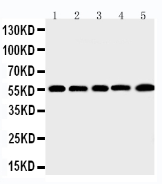 1 - Anti-MMP-12 Antibody ABO11456