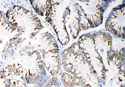 2 - Anti-MMP-14 Antibody ABO11457