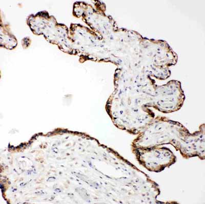2 - Anti-MMP-14 Antibody ABO11457