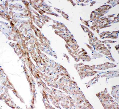 2 - Anti-MMP-14 Antibody ABO11457