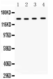 1 - Anti-MMP-14 Antibody ABO11457