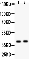 1 - Anti-NDRG2 Antibody ABO11458