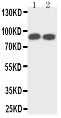 1 - Anti-TrkA Antibody ABO11460