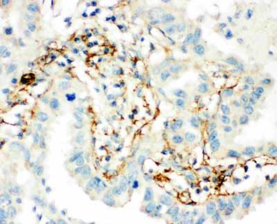2 - Anti-TGM2 Antibody ABO11464
