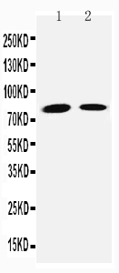 1 - Anti-TGM2 Antibody ABO11464