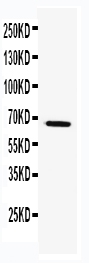 1 - Anti-TRAF5 Antibody ABO11465