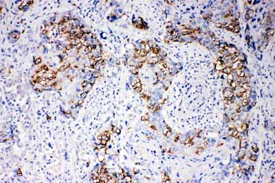 2 - Anti-Beta Arrestin 1 Antibody ABO11466