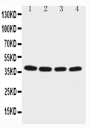 1 - Anti-EIF2S2 Antibody ABO11468
