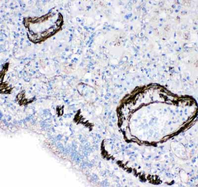 2 - Anti-FABP6 Antibody ABO11469