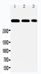 1 - Anti-Laminin 2 Alpha Antibody ABO11471