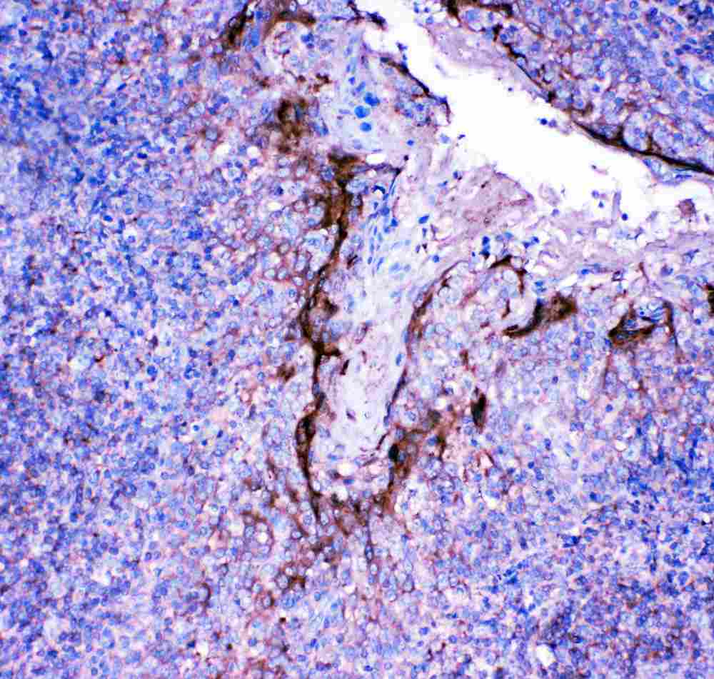 2 - Anti-Profilin 2 Antibody ABO11473