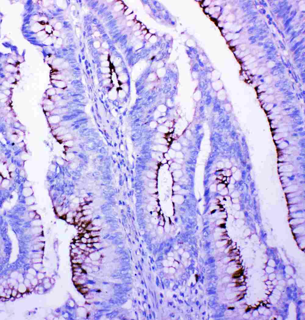 2 - Anti-Profilin 2 Antibody ABO11473