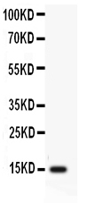1 - Anti-Profilin 2 Antibody ABO11473