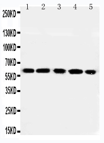 1 - Anti-RGS14 Antibody ABO11474